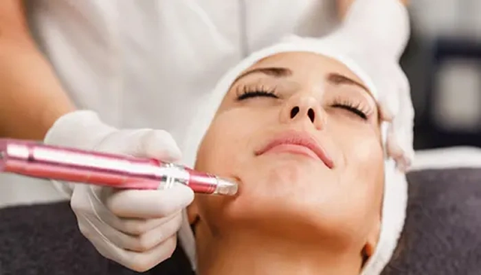 Micro Needling in Coimbatore