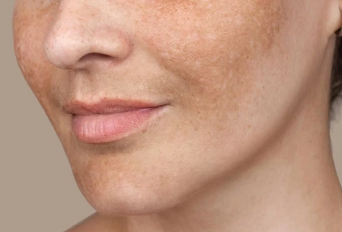  trusted skin care center in Coimbatore