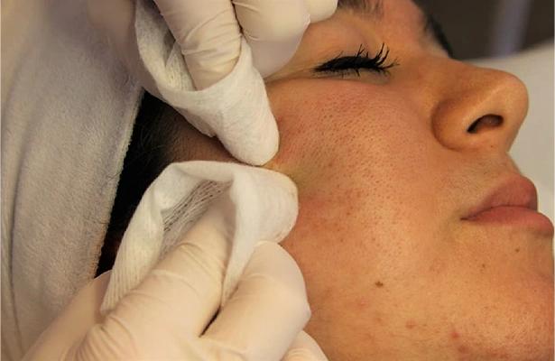 Facial in Coimbatore