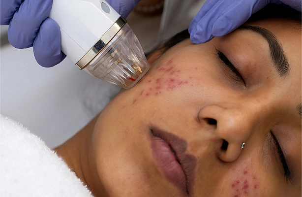 Facial service in Coimbatore
