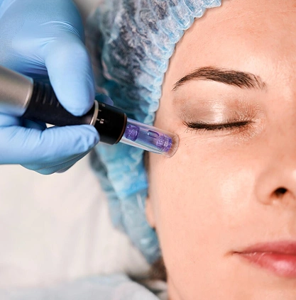 Diamond tip facial in Coimbatore  Diamond tip facial in Coimbatore